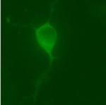 LRRK2 Antibody in Immunocytochemistry (ICC/IF)