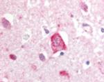 LRRK2 Antibody in Immunohistochemistry (IHC)