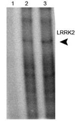 LRRK2 Antibody in Immunoprecipitation (IP)