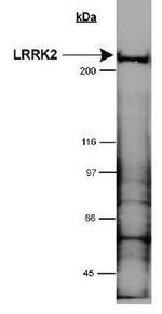 LRRK2 Antibody in Western Blot (WB)