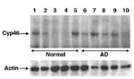 CYP46A1 Antibody in Western Blot (WB)