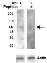 CYP46A1 Antibody in Western Blot (WB)
