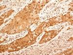 NuMA Antibody in Immunohistochemistry (Paraffin) (IHC (P))