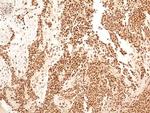 NuMA Antibody in Immunohistochemistry (Paraffin) (IHC (P))