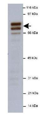 NUMB Antibody in Western Blot (WB)