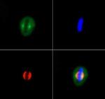 KIF2A Antibody in Immunocytochemistry (ICC/IF)