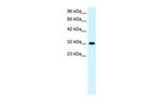 E2F5 Antibody in Western Blot (WB)