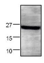 Syndecan 4 Antibody in Western Blot (WB)