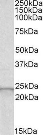 GPX2 Antibody in Western Blot (WB)