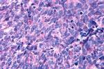 HTR2B Antibody in Immunohistochemistry (Paraffin) (IHC (P))