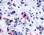 CYSLTR1 Antibody in Immunohistochemistry (Paraffin) (IHC (P))