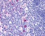 GPCR ORF4 Antibody in Immunohistochemistry (Paraffin) (IHC (P))