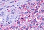 GPCR ORF4 Antibody in Immunohistochemistry (Paraffin) (IHC (P))