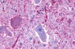 GPCR ORF4 Antibody in Immunohistochemistry (Paraffin) (IHC (P))