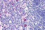 GPCR ORF4 Antibody in Immunohistochemistry (Paraffin) (IHC (P))