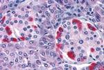GPRC5C Antibody in Immunohistochemistry (Paraffin) (IHC (P))