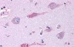 mGluR3 Antibody in Immunohistochemistry (Paraffin) (IHC (P))