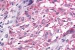 mGluR3 Antibody in Immunohistochemistry (Paraffin) (IHC (P))