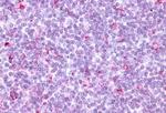 CCR10 Antibody in Immunohistochemistry (Paraffin) (IHC (P))