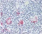 ROR gamma Antibody in Immunohistochemistry (Paraffin) (IHC (P))