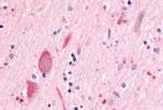 MINK1 Antibody in Immunohistochemistry (Paraffin) (IHC (P))