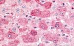MINK1 Antibody in Immunohistochemistry (Paraffin) (IHC (P))