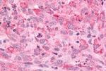 MINK1 Antibody in Immunohistochemistry (Paraffin) (IHC (P))