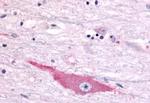 DUSP22 Antibody in Immunohistochemistry (Paraffin) (IHC (P))