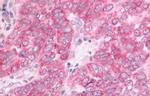 DUSP22 Antibody in Immunohistochemistry (Paraffin) (IHC (P))