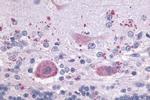 LPAR4 Antibody in Immunohistochemistry (Paraffin) (IHC (P))