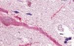 GPR160 Antibody in Immunohistochemistry (Paraffin) (IHC (P))