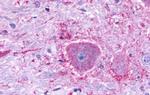 NTSR2 Antibody in Immunohistochemistry (Paraffin) (IHC (P))