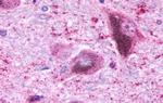 NTSR2 Antibody in Immunohistochemistry (Paraffin) (IHC (P))