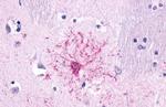 NTSR2 Antibody in Immunohistochemistry (Paraffin) (IHC (P))