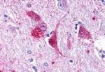 GPR37 Antibody in Immunohistochemistry (Paraffin) (IHC (P))