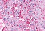 GPR37 Antibody in Immunohistochemistry (Paraffin) (IHC (P))