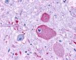 GPR37 Antibody in Immunohistochemistry (IHC)