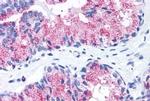 FZD1 Antibody in Immunohistochemistry (Paraffin) (IHC (P))