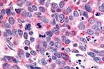 LS189744 Antibody in Immunohistochemistry (Paraffin) (IHC (P))