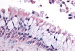 LS189744 Antibody in Immunohistochemistry (Paraffin) (IHC (P))