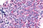 LS189744 Antibody in Immunohistochemistry (Paraffin) (IHC (P))