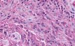 GPR137B Antibody in Immunohistochemistry (Paraffin) (IHC (P))