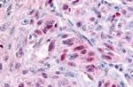 NR1D2 Antibody in Immunohistochemistry (Paraffin) (IHC (P))