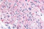 MRGPRX4 Antibody in Immunohistochemistry (Paraffin) (IHC (P))