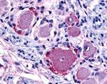 MRGPRX4 Antibody in Immunohistochemistry (IHC)