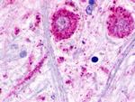 TAAR3 Antibody in Immunohistochemistry (Paraffin) (IHC (P))