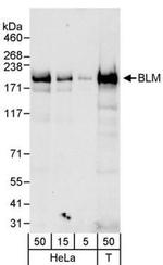 Blooms Syndrome Antibody in Western Blot (WB)