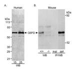G6PD Antibody in Western Blot (WB)