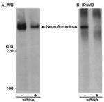 NF1 Antibody in Western Blot (WB)