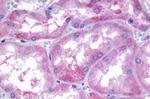 EDG3 Antibody in Immunohistochemistry (Paraffin) (IHC (P))